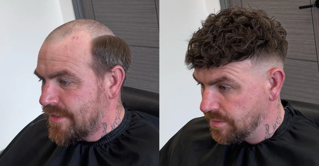 Before and after a hair system fitting